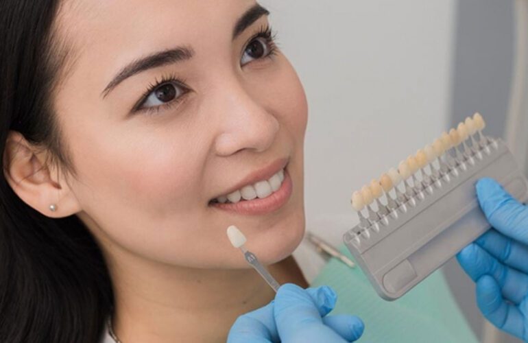 Woman comparing dental veneer shades with a dentist before cosmetic smile treatment.
